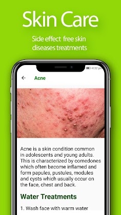Download Herbal Home Remedies and Natural Cures Mod Apk