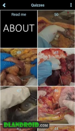 Autopsy Apk Full