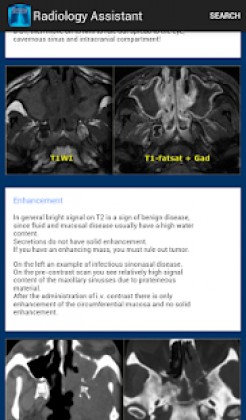 Radiology Assistant Apk